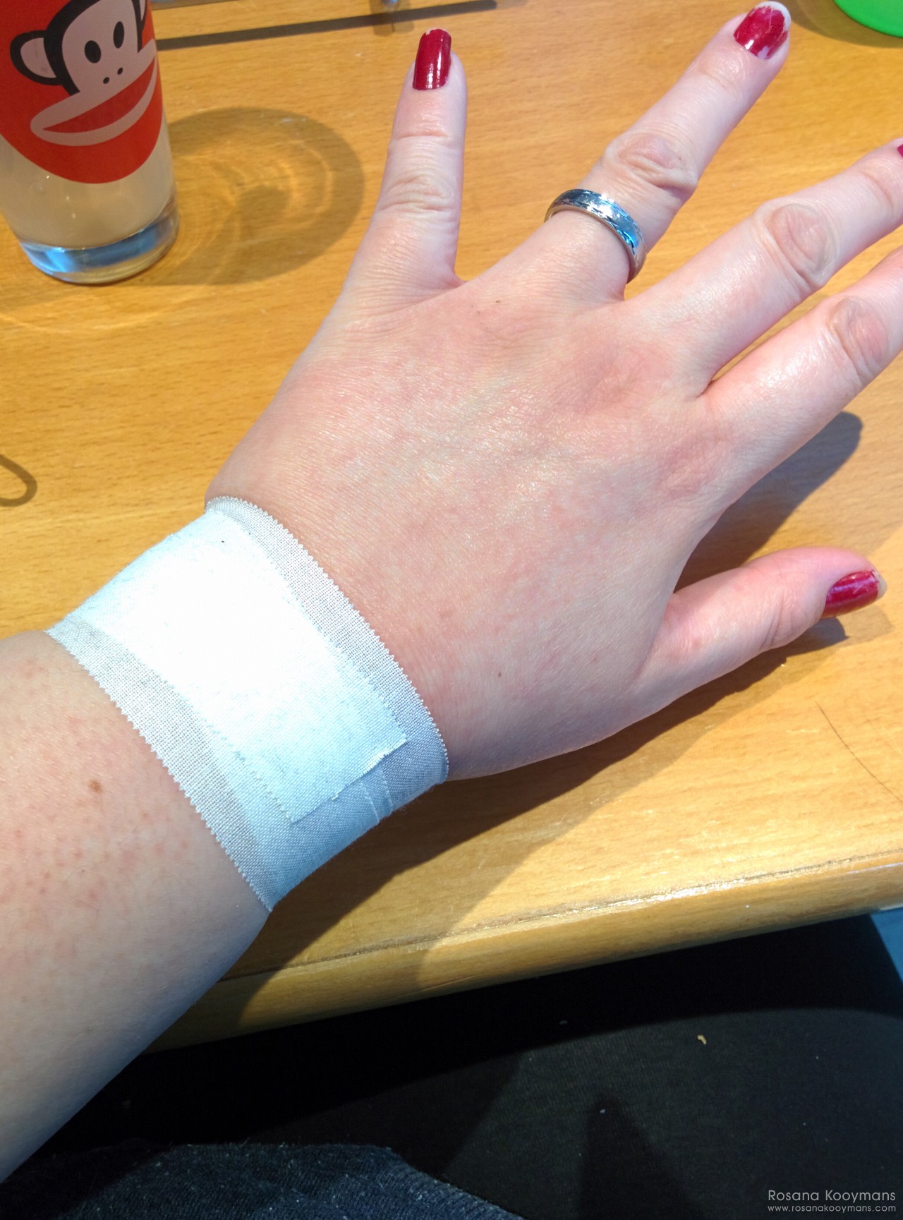 Stupid wrist! 365 - May 4, 2017: Stupid wrist!